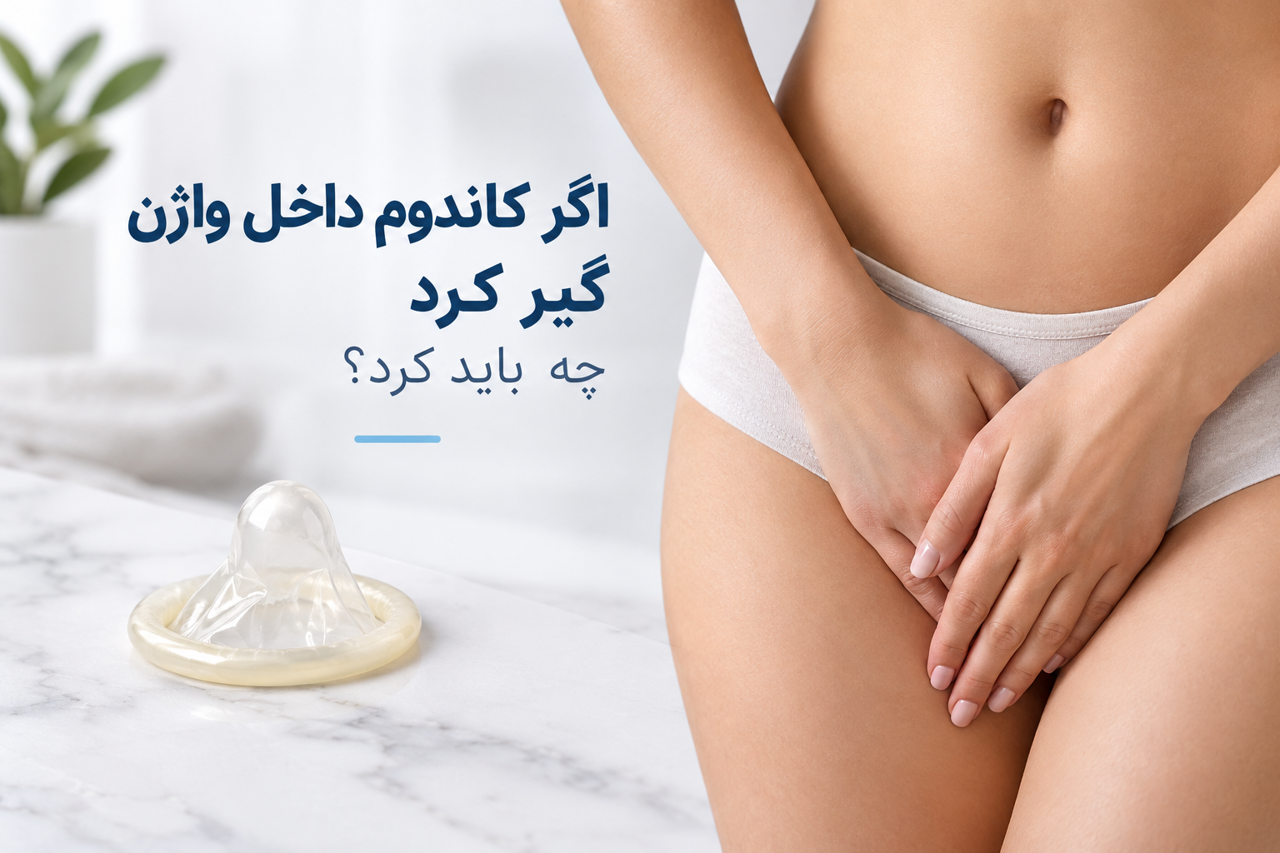 اگر کاندوم داخل واژن گیر کرد چه باید کرد؟